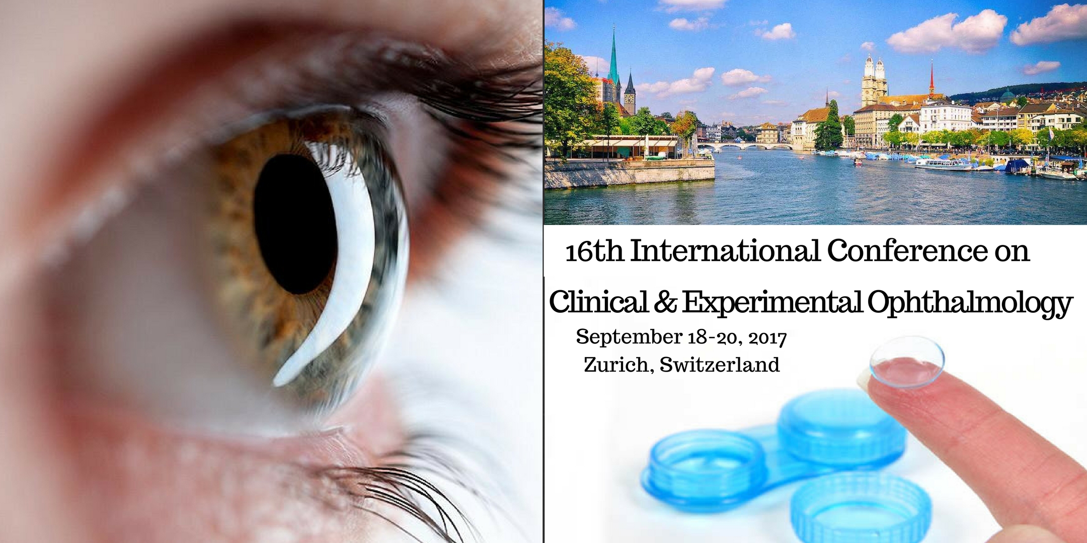 We cordially invites you to participate at the 16th International Conference on Clinical and Experimental Ophthalmology (CME+CPD accredited) to be held during September 18-20, 2017 at Zurich, Switzerland. The theme of the conference is Accelerating the science of eye which highlights the significance of vision and also explores the spectrum of latest technological developments in the field of Ophthalmology.